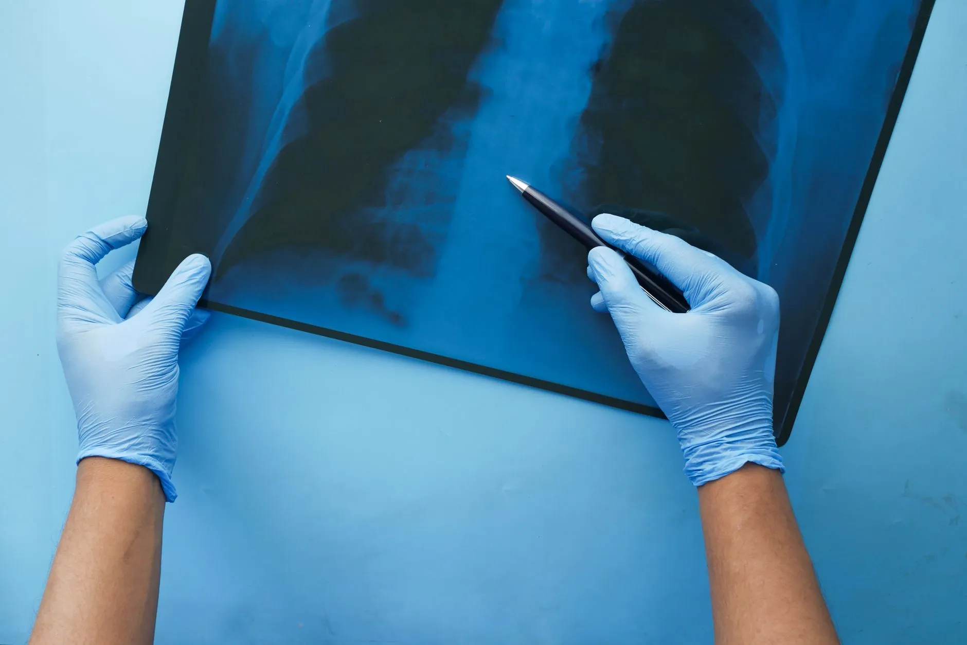 精装企业宿舍智能化改造方案与租赁管理效率提升实践